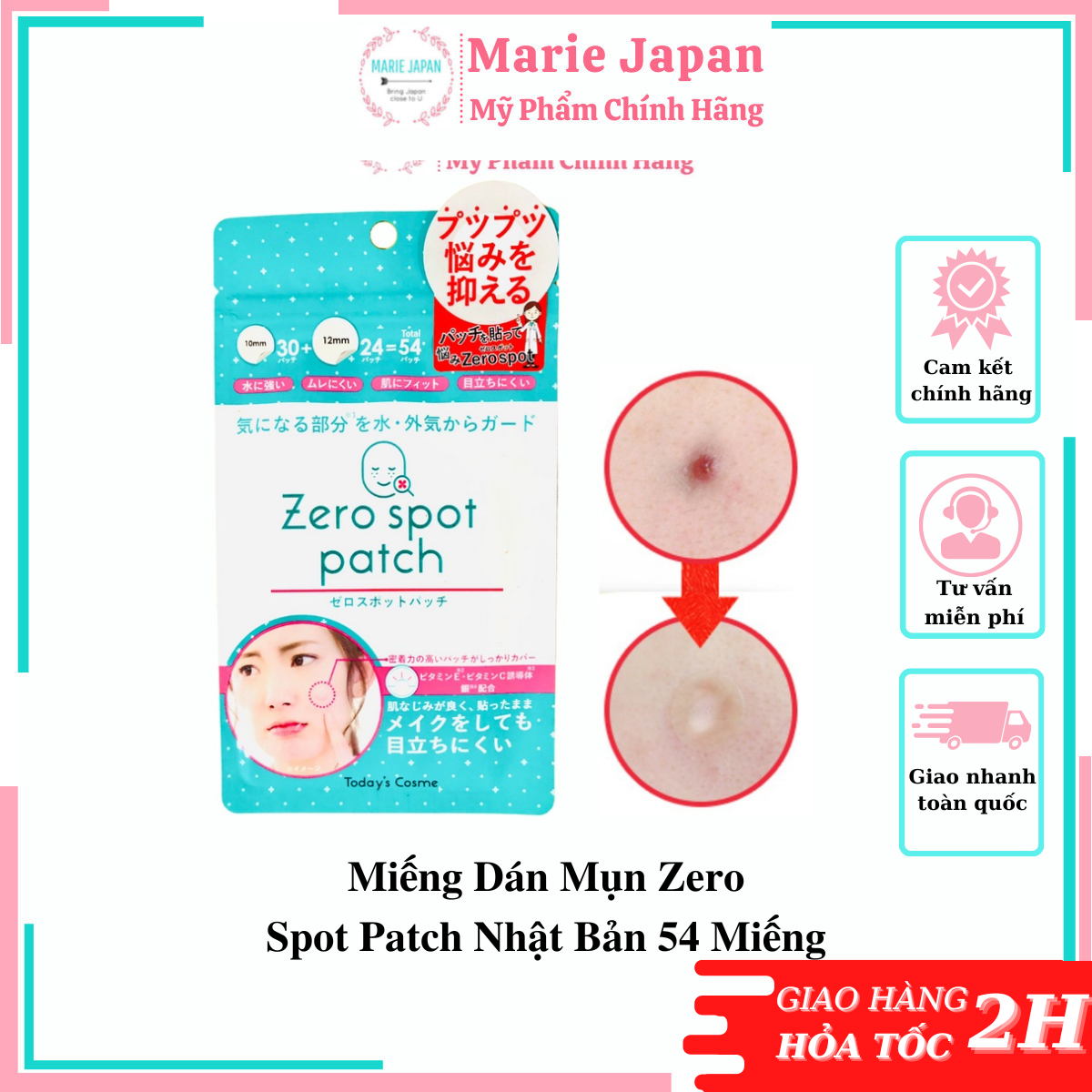 Miếng Dán Mụn Zero Spot Patch Nhật Bản 54 Miếng