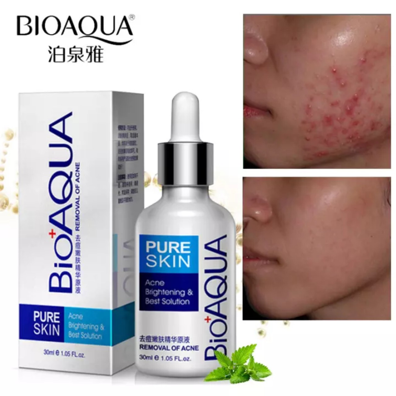Tinh Chất BIOAQUA Xóa Mụn Mờ Thâm sẹo 30ml