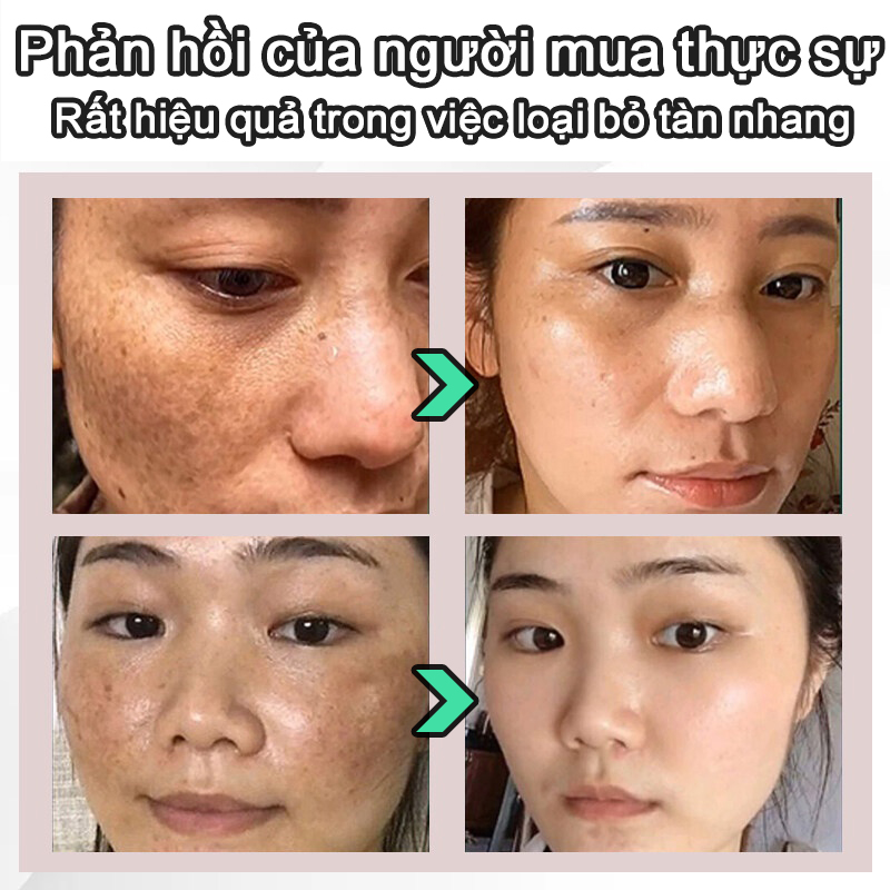 tinh chất làm trắng serum thâm mụn Huyết thanh chống tàn nhang sử dụng trắng hết nhăn nám tàn nhang không tì vết chất làm săn chắc lỗ chân lông tinh chất dưỡng ẩm mặt thu nhỏ lỗ chân lông săn chắc 100ml