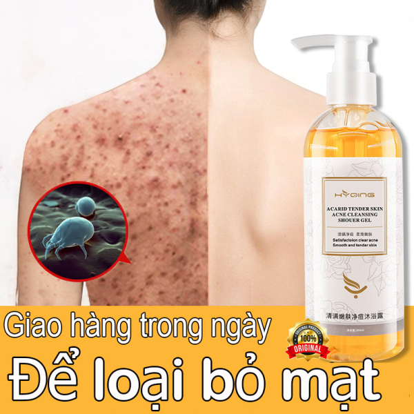 acne body wash Sữa tắm diệt ve và loại bỏ mụn  trẻ hóa da  đa dưỡng chất  kiềm dầu  thảo mộc loại bỏ bụi bẩn  sữa tắm làm sạch nhẹ nhàng 260 ml  sữa tắm chà bùn  thông dụng cho gia đình  an toàn