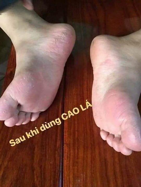 Cao Lá Thanh Mộc Hương Thuần Mộc 150g