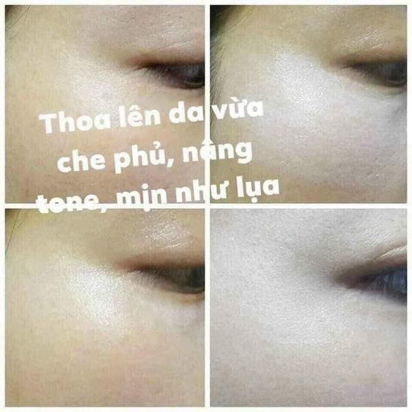 Combo 10 vỉ cao nám whoo radiant white intensive spot corrector