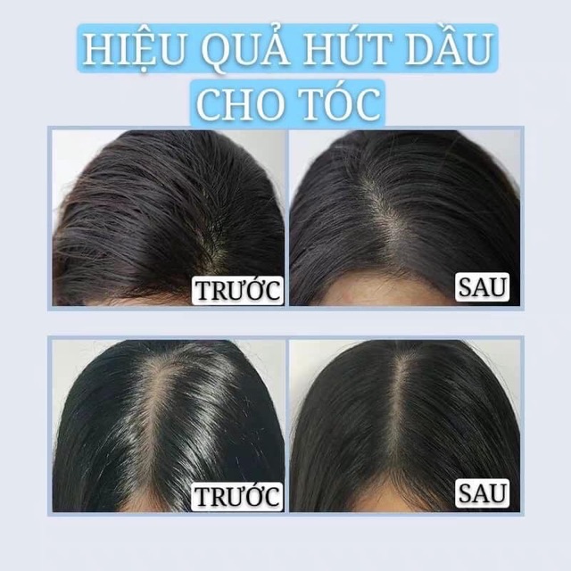 Dầu gội khô iSSY/ 150ml