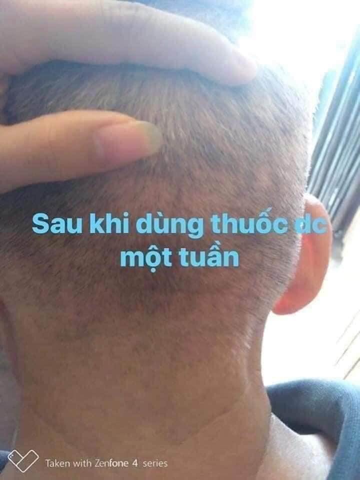 [HCM]Kem bôi da Thảo Mộc Nam