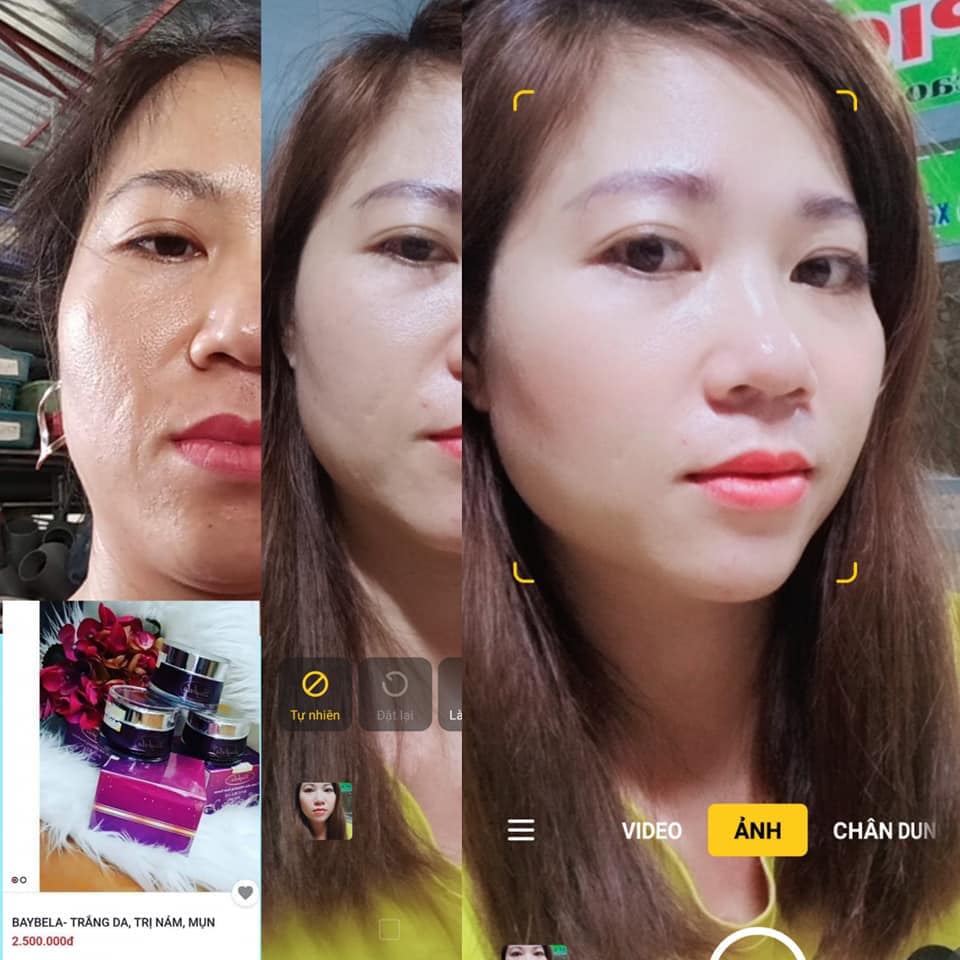Bộ 3 kem Baybela Hàn quốc