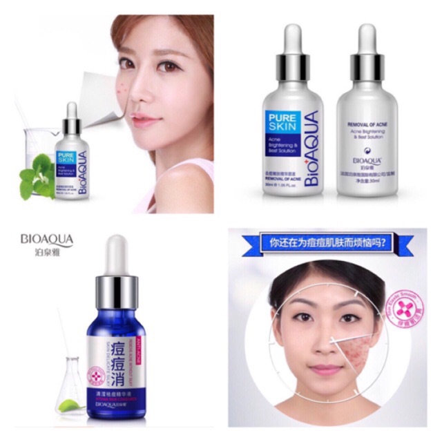 Serum trị mụn của bioaqua
