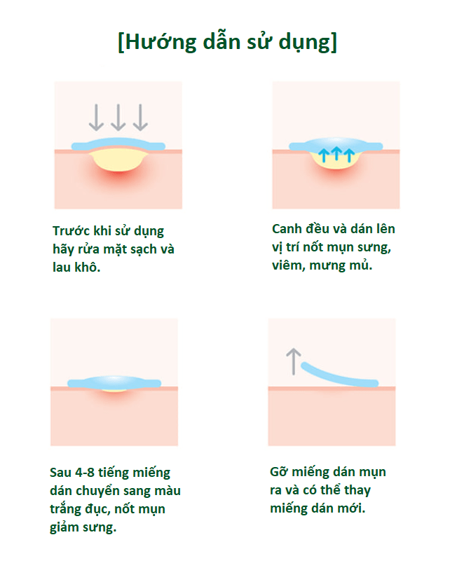 Miếng Dán Mụn Some By Mi