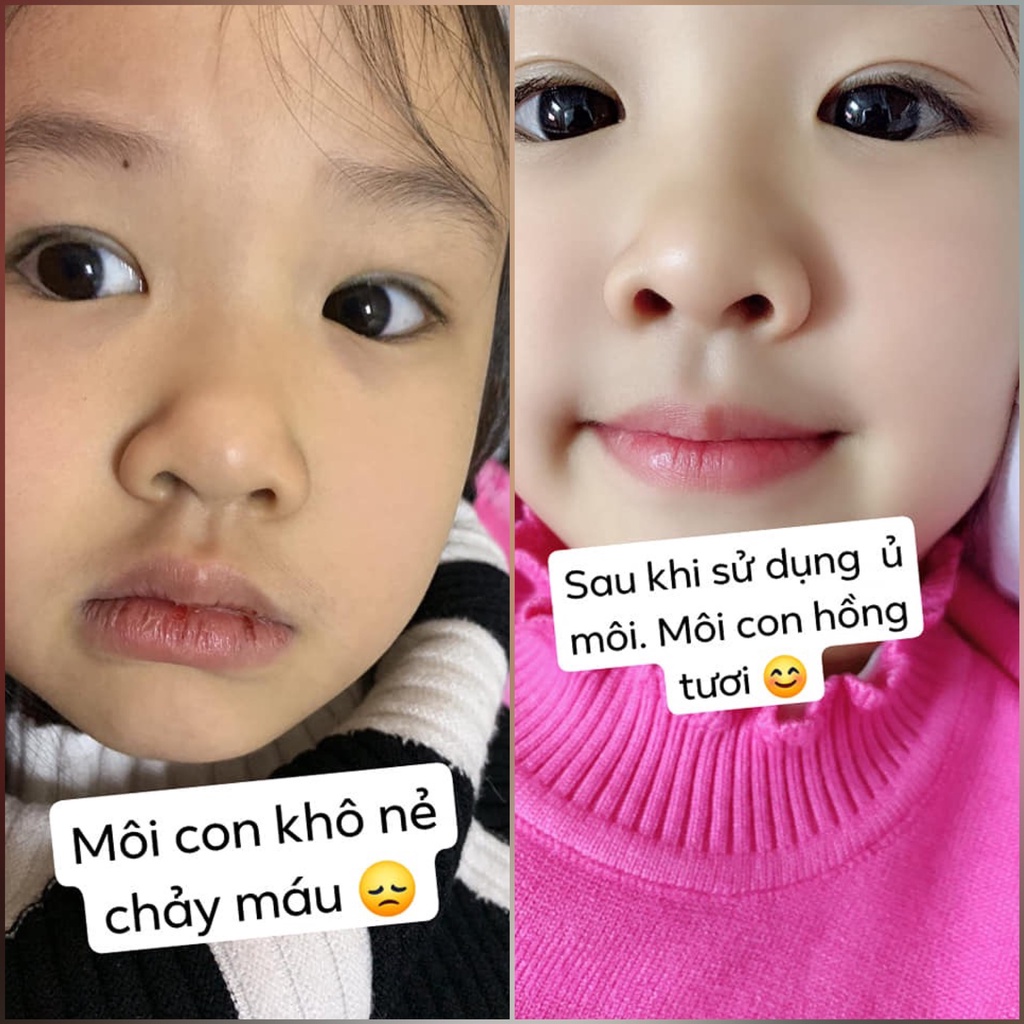 Mặt nạ ủ môi