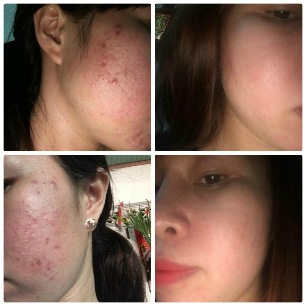 [HCM]Thảo dược Đông Y Lê Xuân