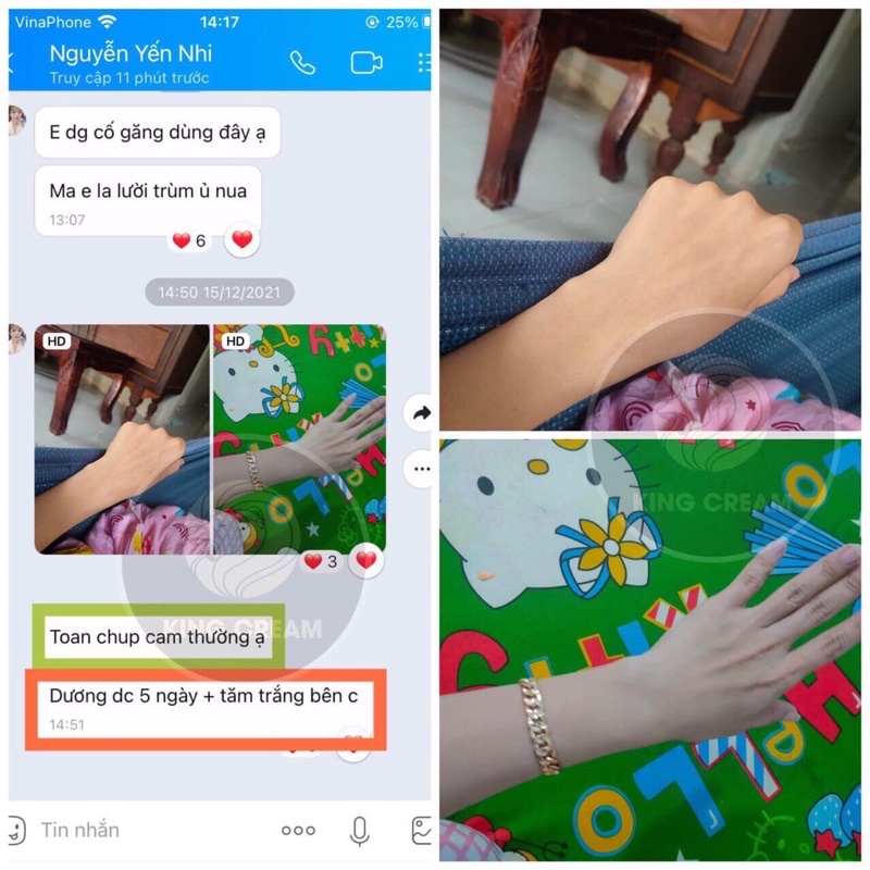 KEM BODY KING CREAM Hoàng gia Dát Vàng