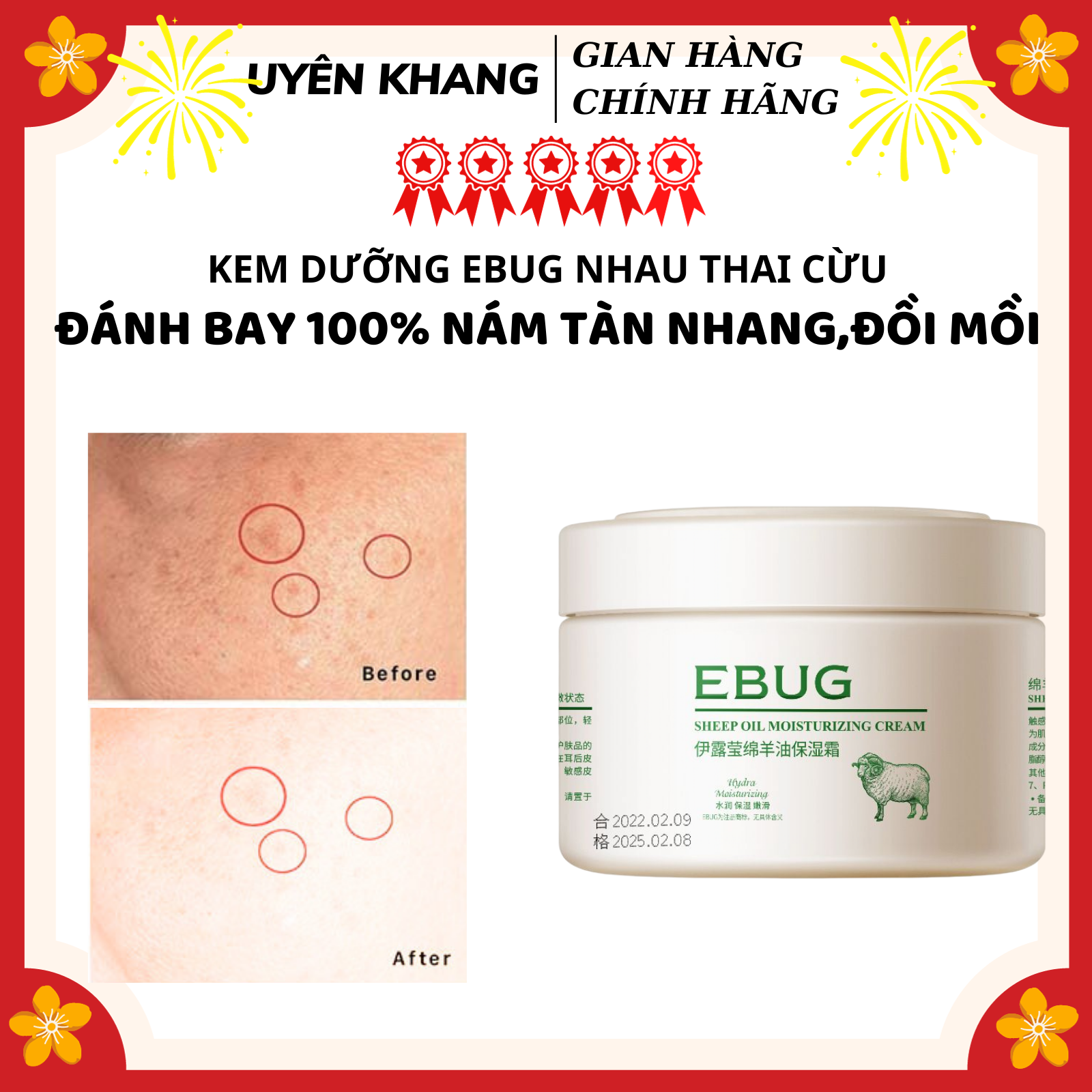 KEM EBUG SỮA DÊ HẾT Kem làm mờ vết thâm làm trắng da Serum xóa vết thâm làm sáng da giảm đốm tàn nhang Kem làm trắng và loại bỏ nám tàn nhang hiệu quả loại bỏ các hắc tốt melanin và chăm sóc da trắng sáng tự nhiên