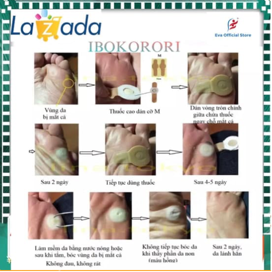 [BEST SELLER - CHÍNH HÃNG] Miếng dán mụn cóc mắt cá chân Ibokorori Nhật bản (hộp 12 miếng dán )