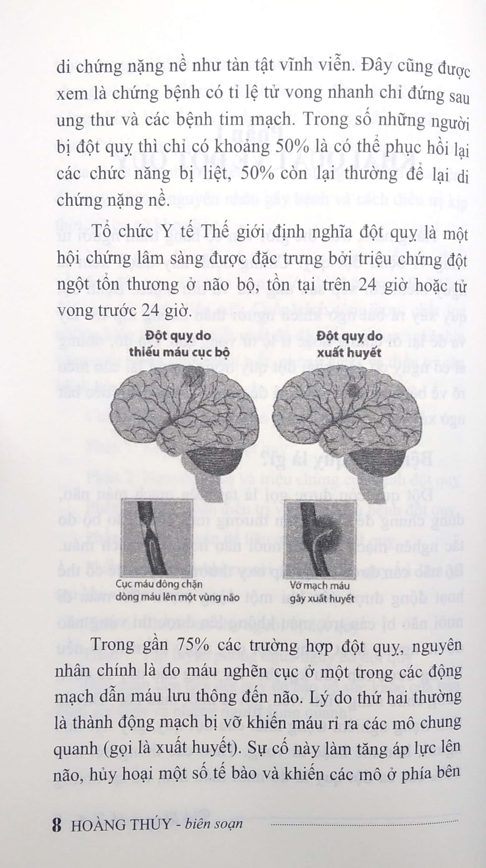 Sách Fahasa - Bệnh Đột Quỵ Và Cách Điều Trị