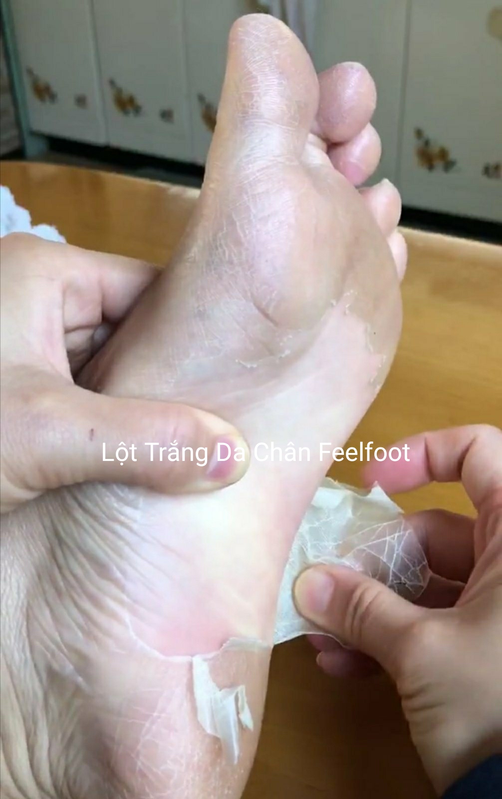 [HCM]Feelfoot Lột Trắng Da Chân Hết Chai Sần