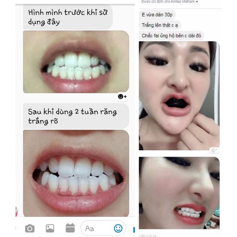 COMBO [LIỆU TRÌNH 14 NGÀY DÁN TRẲNG RĂNG ANRIEA 3D + KEM ĐÁNH RĂNG CHANH] TẶNG miếng dán lẻ + 1 bàn chải + 1 smile maker