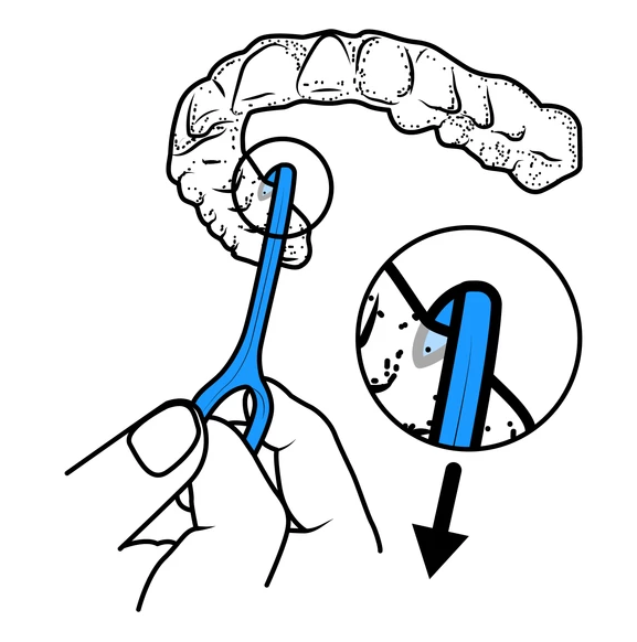 Cây tháo máng chỉnh nha PT Protect (Invisalign, ClearAlign)