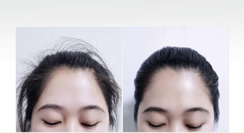 Chuốt tóc con thần thánh [SIÊU HOT] chuốt gọn tóc tơ, tóc con.TKVT2