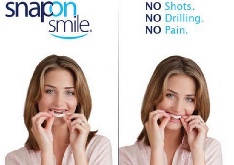 Euro Quality - Răng thẩm mỹ Snap on smile