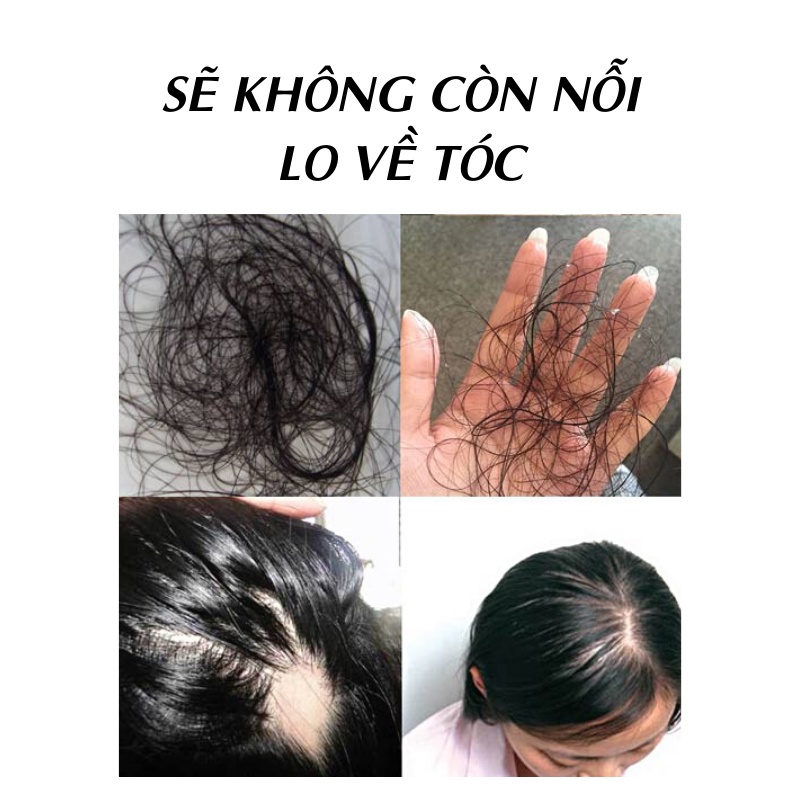 Bồ kết khô 1kg - Thảo Dược Tấn Phát