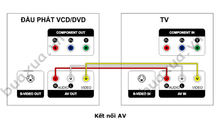 CÁP AV 6 ĐẦU BÔNG SEN - 1,5M