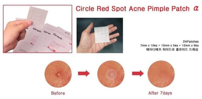 Miếng dán mụn Ciracle Red Spot Acne Pimple Path 24 Miếng