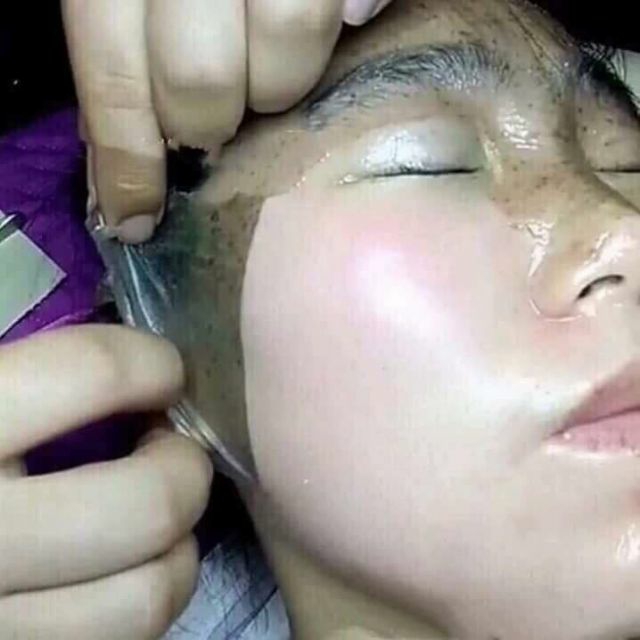 [HCM]Mặt nạ màng tế bào gốc GoGo