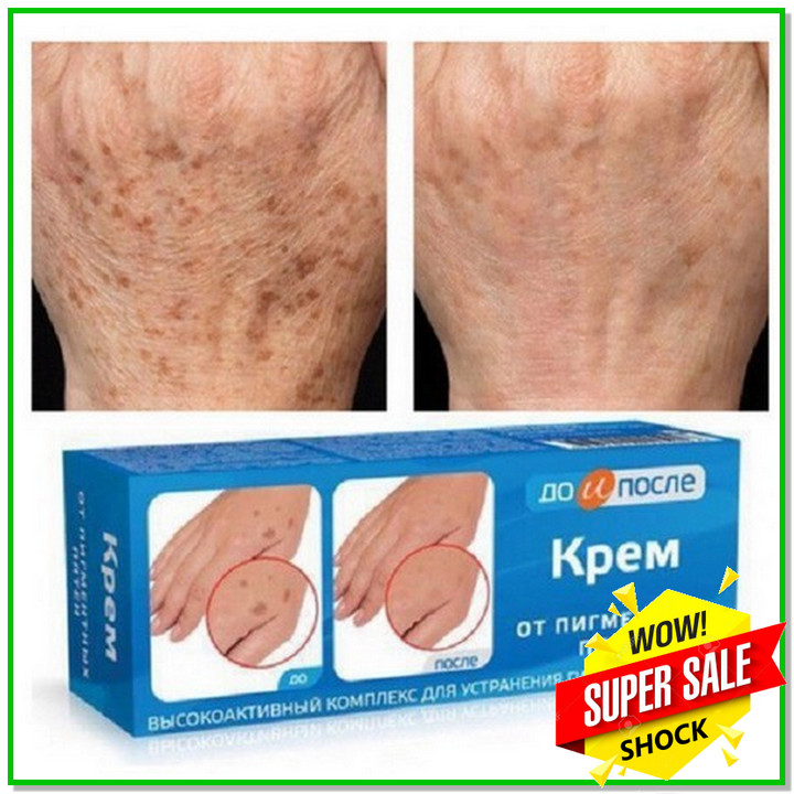 Kem đồi mồi Kpem Nga 50ml