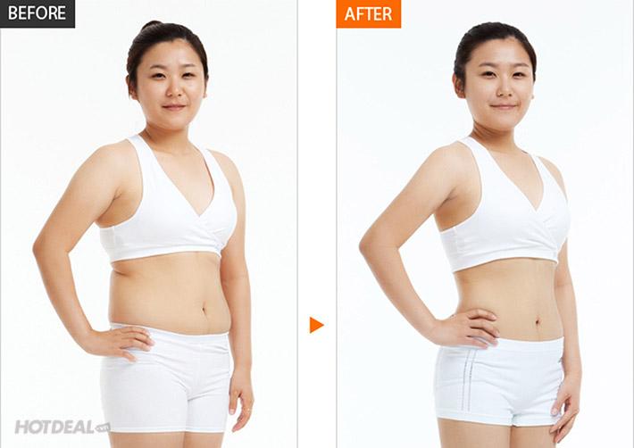 Bộ 30 Miếng Dán Tan Mỡ Bụng Mymi Wonder Patch Hàn Quốc