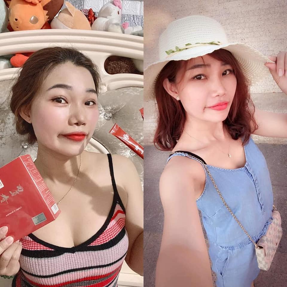 Bách Hoa Tiên Las Beauty - Cốm Uống Đẹp Da [Chính Hãng]