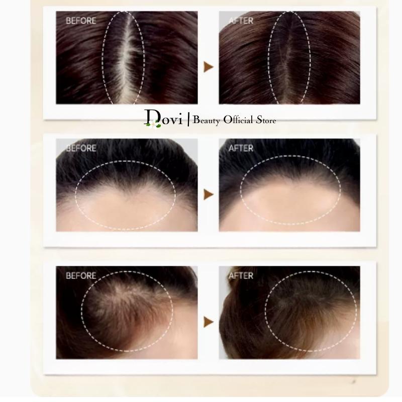 Phấn Phủ , Phấn Che Khuyết Điểm Tóc MAYCHEER Che Phủ Tóc Hói Làm Hiệu Ứng Dày Chân Tóc