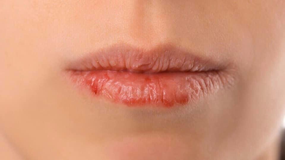 son dưỡng môi