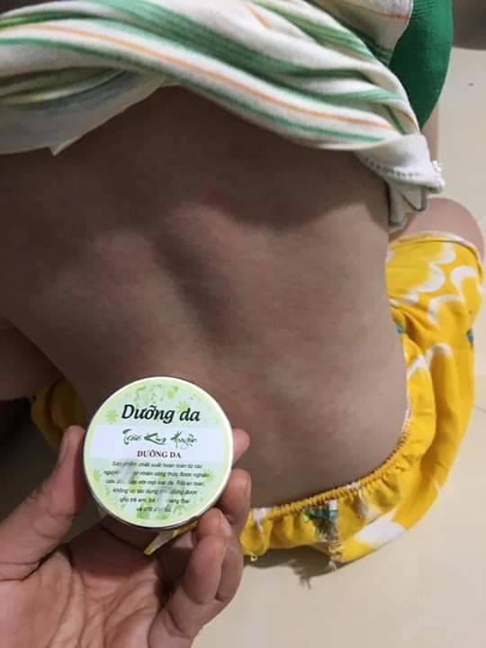 DƯỠNG DA TRẦN KIM HUYỀN - 0183