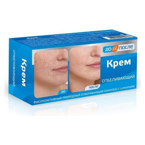 Kem giảm ngừa nám và tàn nhang KpeM nga