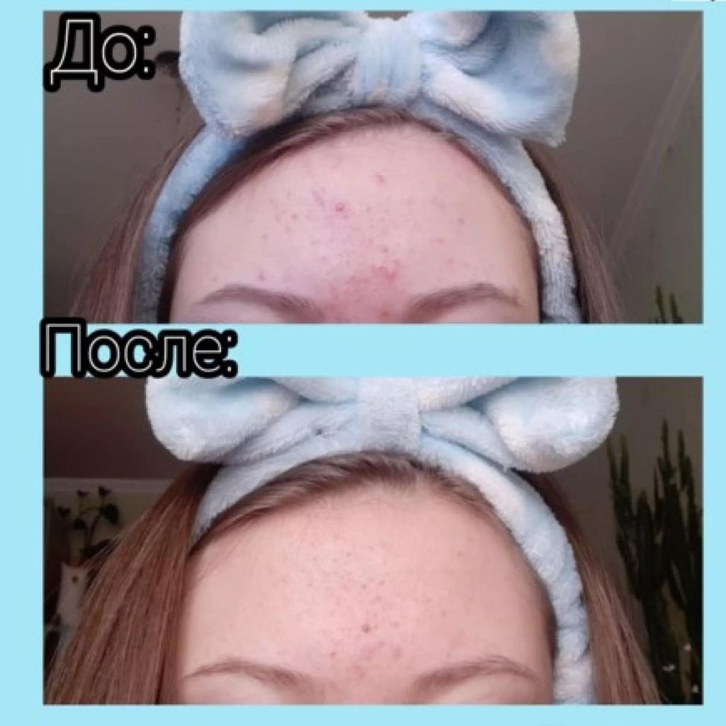 Sữa Rửa Mặt Giảm Mụn Compliment No Problem BHA 200ml