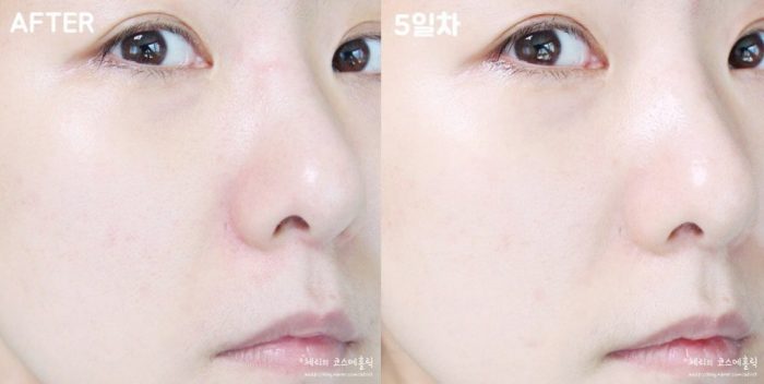 Tẩy tế bào da chết Ohui Clear Science Soft Peeling 100ml / 150ml