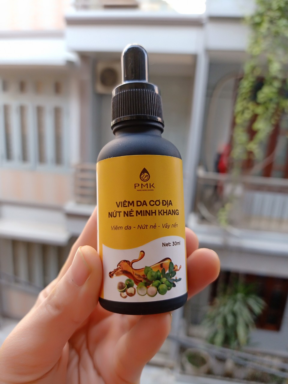 Viêm da nứt nẻ vẩy nến Phúc Minh Khang