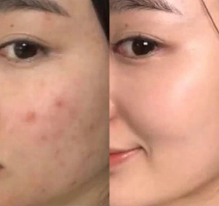 Serum Hỗ Trợ Phục Hồi Da Gogreen SMAS Pro Vitamin B5