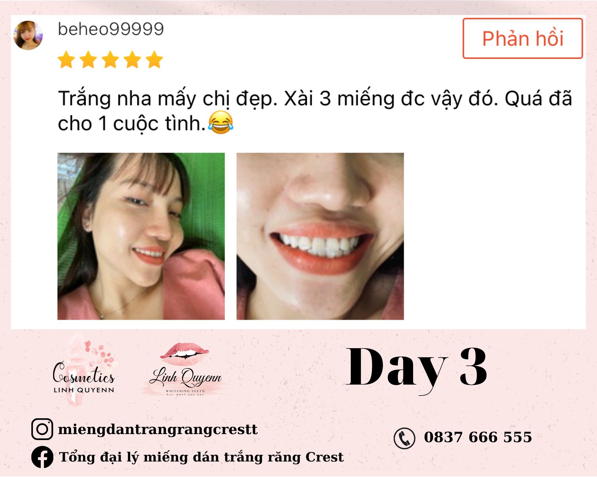 Kem Đánh Răng Crest Gum Detoxify Siêu Trắng 147gr
