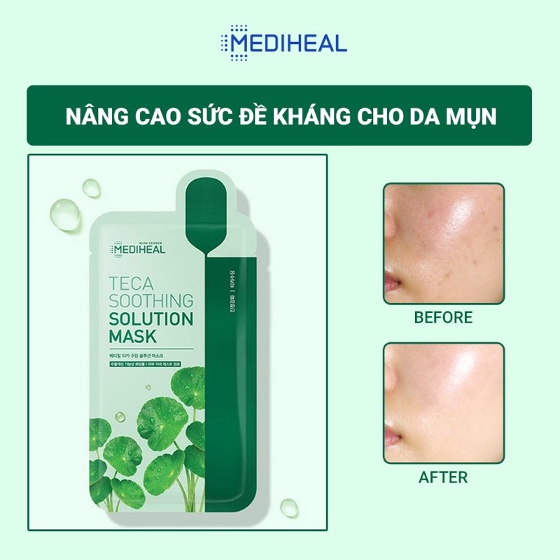 Mặt Nạ Mediheal Ampoule Mask/Solution Mask/Essential Mask Ex