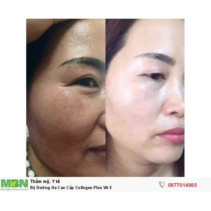 Bộ kem cao cấp colagen Plus Vit e (kem ngày đêm kèm xà phòng)