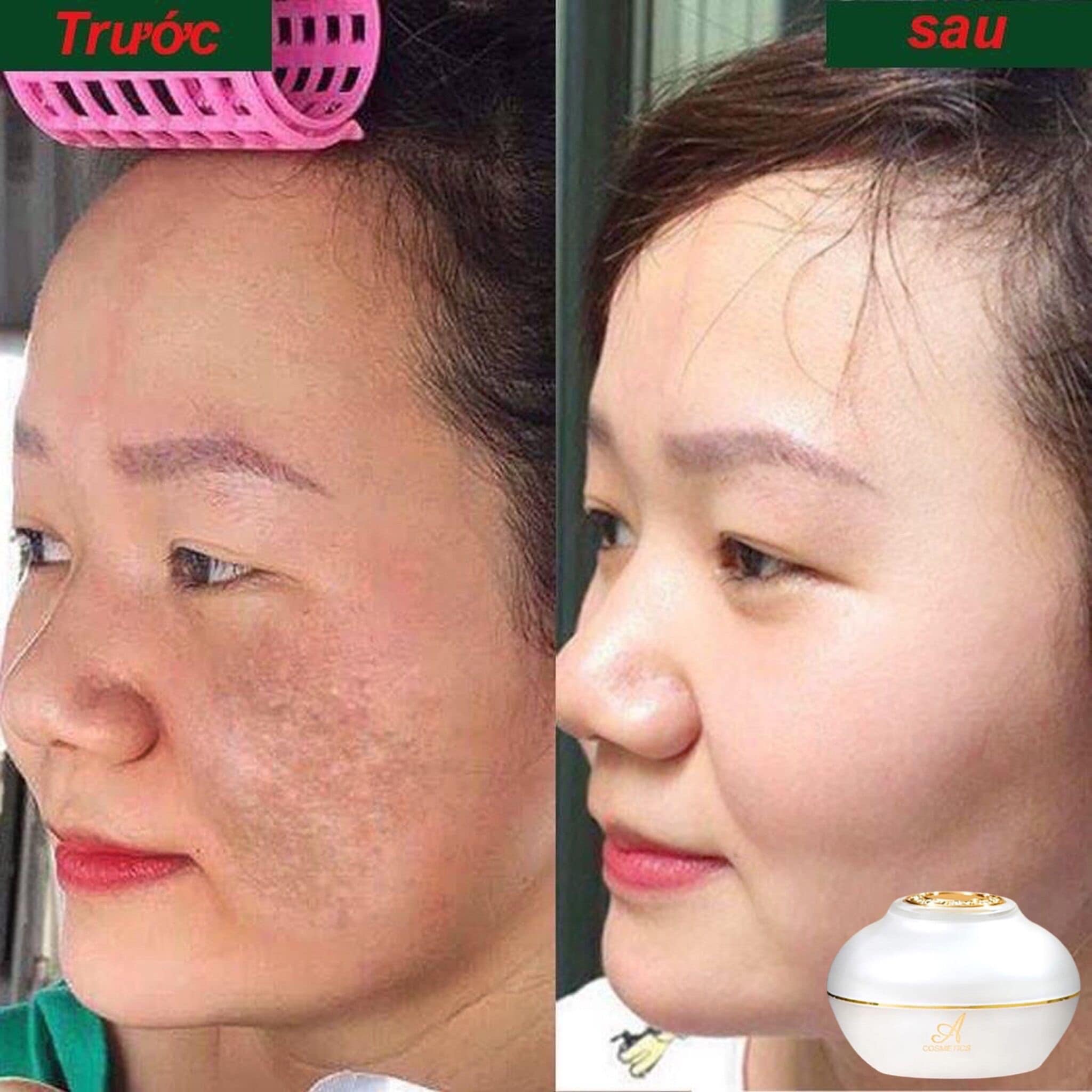 Kem dưỡng da, kem Face Pháp