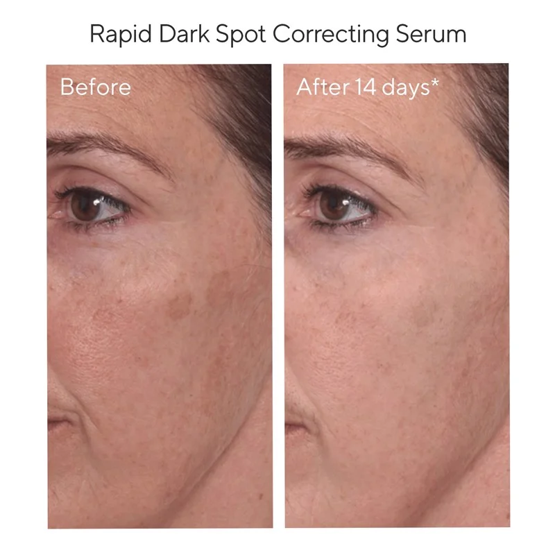 Tinh chất cải thiện nám và giảm sự hình thành đốm nâu Murad Rapid Dark Spot Correcting Serum 30ml