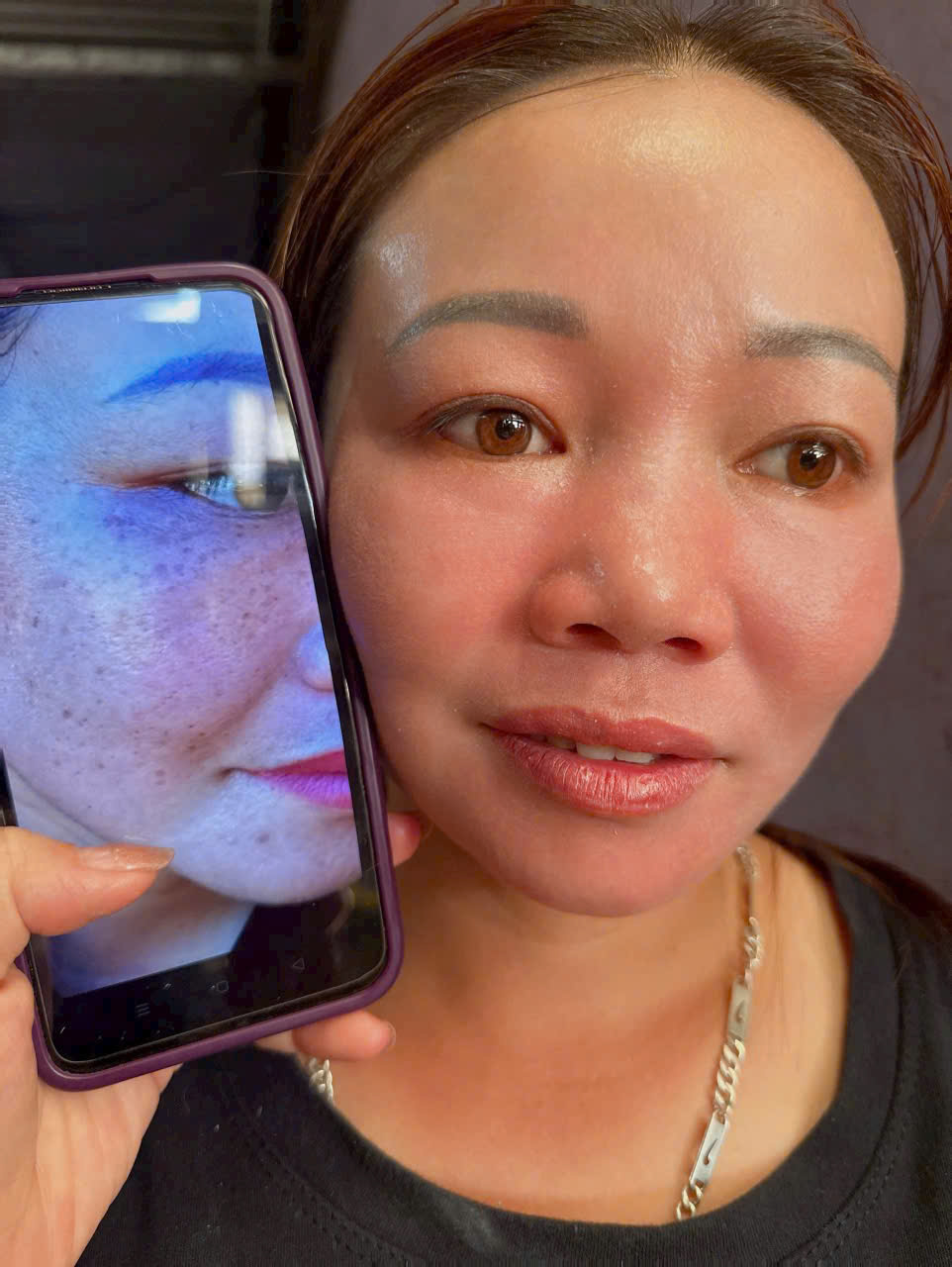 [Chính Hãng].Chấm Tàn Nhang không đau rát Yody Phương Anh dạng gel phù hợp với mọi loại da