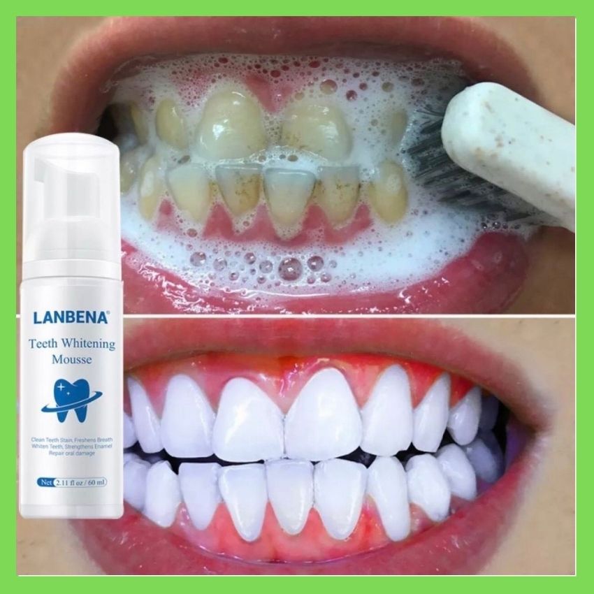 [Hàng Hót]Kem Tẩy Trắng Răng Lanbena, Làm Trắng Sáng Răng, Tẩy Sạch Vết Ố Vàng, Khử Mùi Hôi Miệng, Loại Bỏ Các Mảng Bám