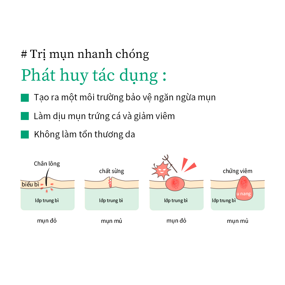 BREYLEE Acne Patch 22 Dots (Night Use ) BREYLEE Miếng dán mụn 22 chấm (Sử dụng ban đêm)