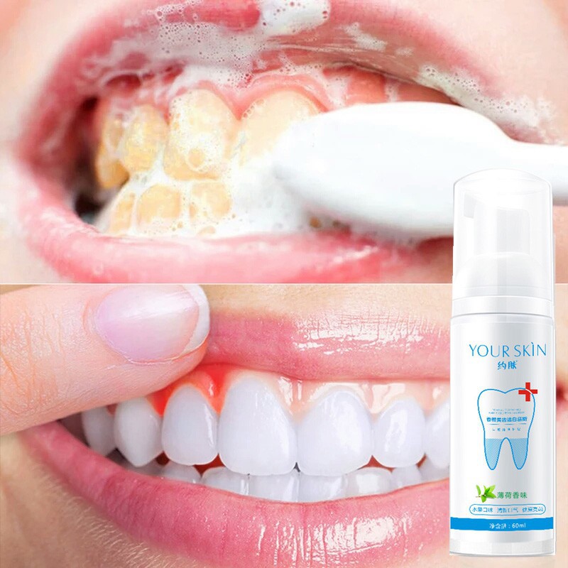 Kem Đánh Răng Your Skin hiệu quả vượt trội
