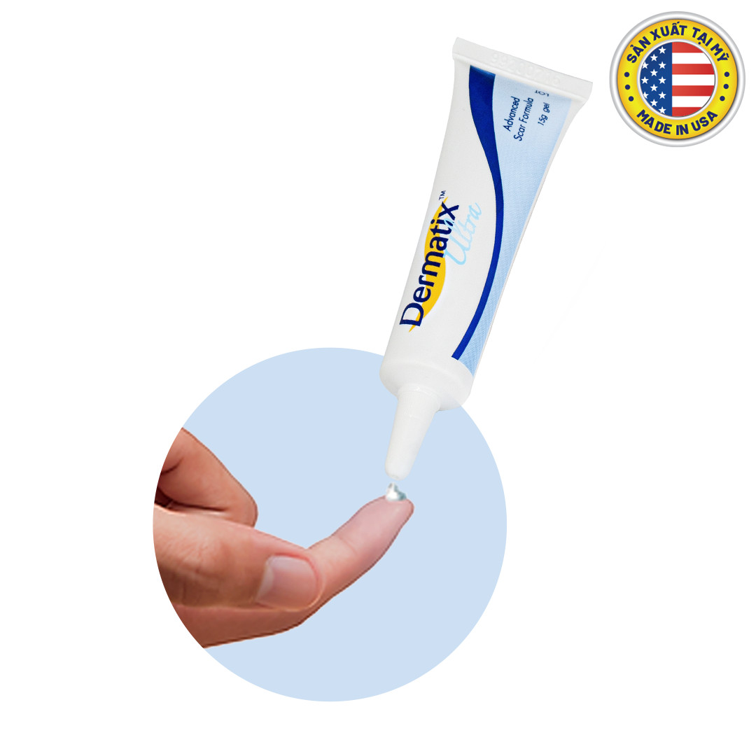 [GIẢM 20K ĐƠN 399K] Dermatix Ultra Gel Làm Mờ Sẹo 7g