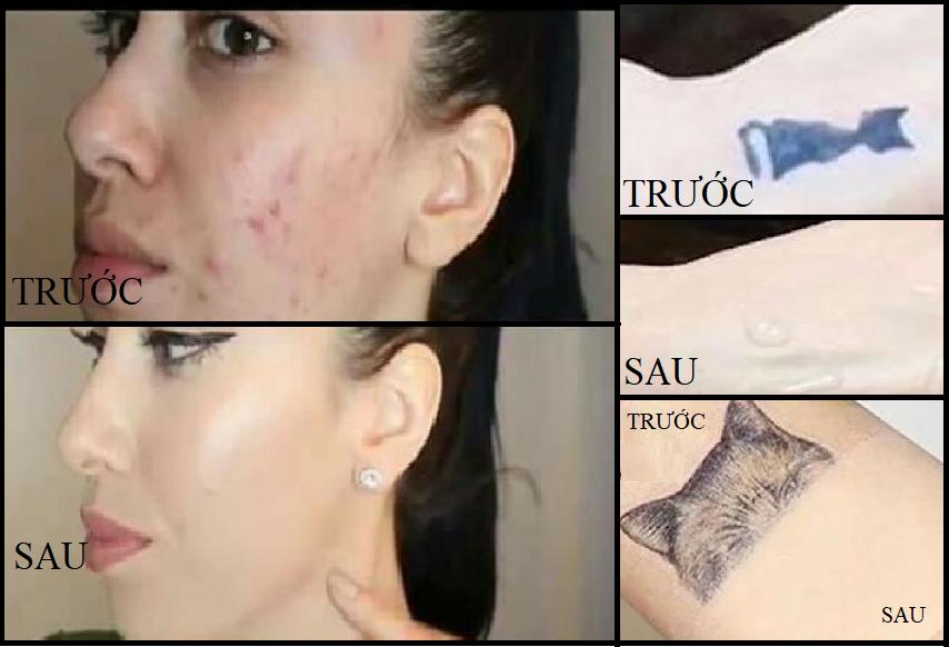 Kem Che Khuyết Điểm Dermacol Waterproof SPF30 - 30g