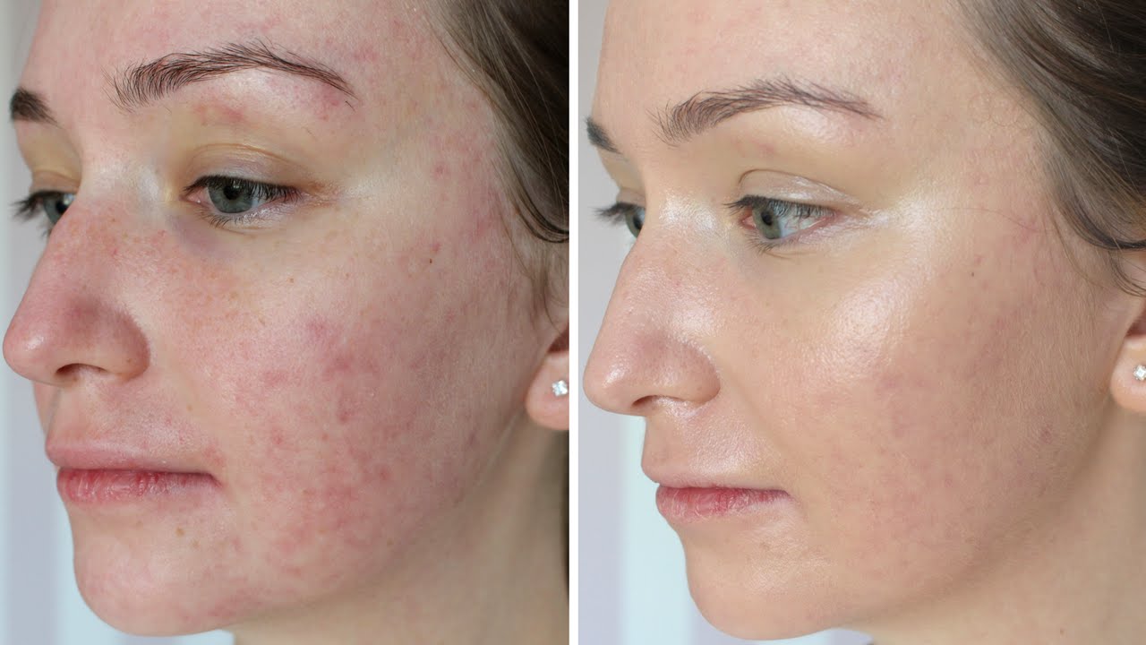 CC LUMENE, CC QUỐC DÂN