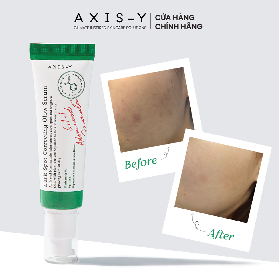 Combo serum dưỡng sáng mờ thâm và tinh chất chấm mụn 65ml
